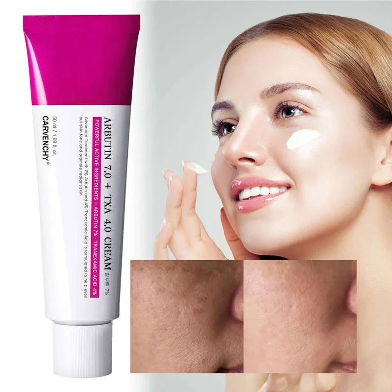 Arbutin Nicotinamide Cream