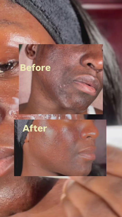 Arbutin Nicotinamide Cream